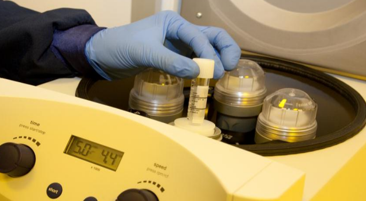 Semen analysis at Cambridge IVF